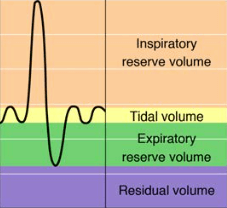 A spirometry chart showing a Vital Capacity Movement, with different colours indicating the Inspiratory reserve volume, Tidal volume, Expiratory reserve volume and Residual volume.